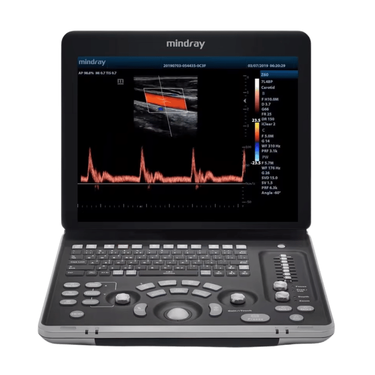Mindray Z60